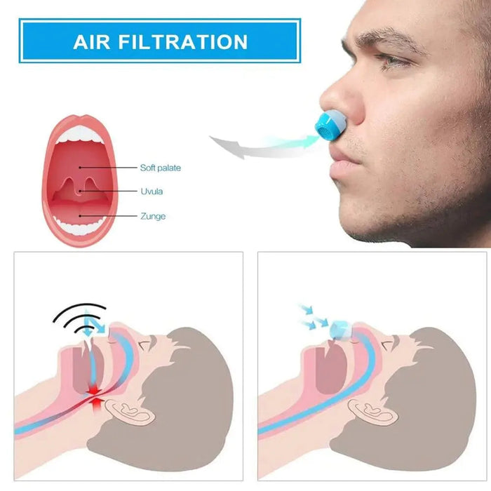 Micro Cpap Machine For Sleep Apnea | Cpap Anti Snoring Device