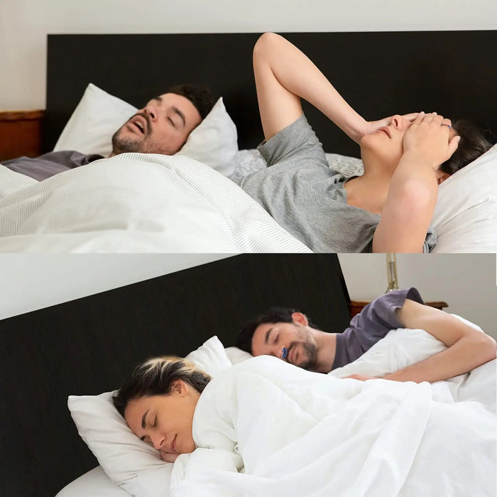 Micro Cpap Machine For Sleep Apnea | Cpap Anti Snoring Device